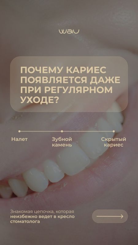 ��� ���������� �� ������� ����� � �������: ����������� ���������