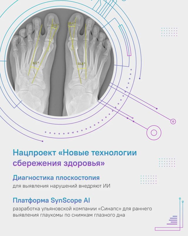 Как нацпроекты технологического лидерства меняют экономику и медицину Ульяновской области? Как нацпроекты технологического лидерства меняют экономику и медицину Ульяновской области?